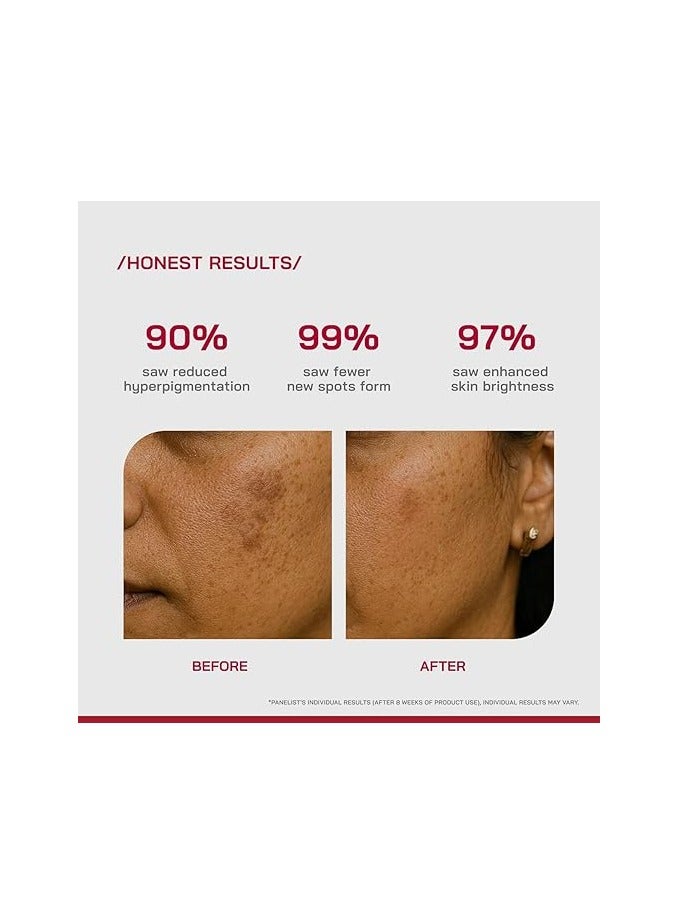PHD 2% Alpha Arbutin Depigmentation Serum 30ml - Image 4