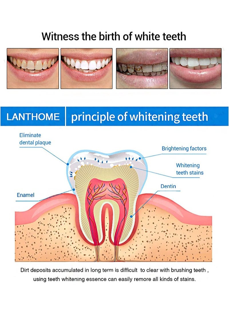 Lanthome - 2Pcs Teeth Whitening Essence，Teeth Whitening Pen，Purely White Deluxe Teeth Whitening Kit，Oral Care， Best Teeth Whitening Products，Intensive Stain Removal Teeth Reduce Yellowing - Image 1