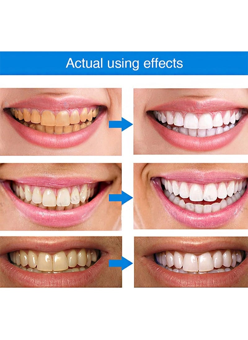 Lanthome - 2Pcs Teeth Whitening Essence，Teeth Whitening Pen，Purely White Deluxe Teeth Whitening Kit，Oral Care， Best Teeth Whitening Products，Intensive Stain Removal Teeth Reduce Yellowing - Image 1