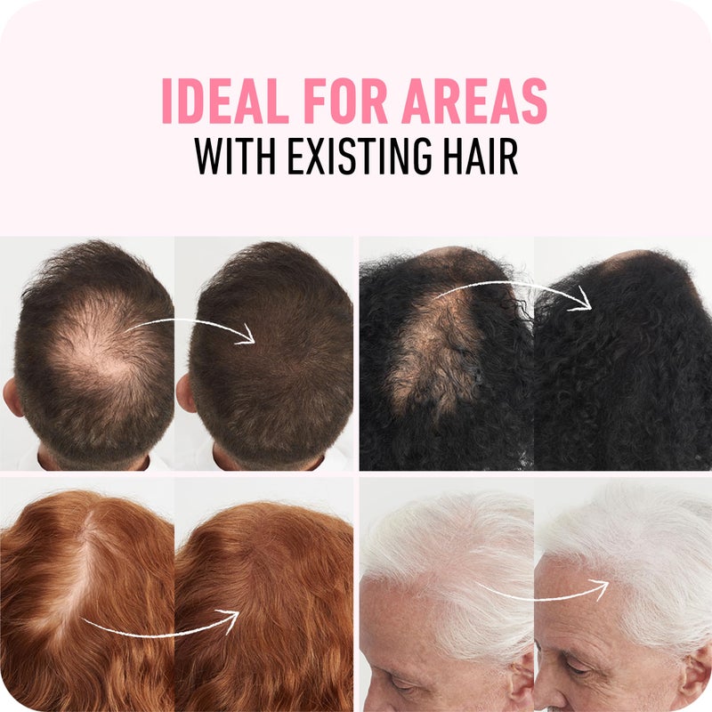 BOLDIFY Hair Fibers (2 x 56g) - Fill In Thinning and Fine Hair for an Instantly Fuller, Thicker Look - 14 Shades for Women & Men - Dark Brown - Image 4