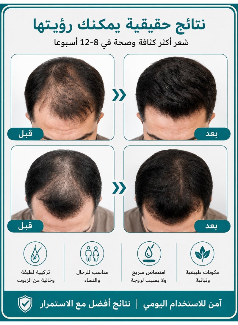 Kormesic Professional 5% Minoxidil & Keratin Hair Growth Serum – Activate Follicles, Strengthen Roots, and Combat Thinning with Korean-Infused Scalp Care - Image 3