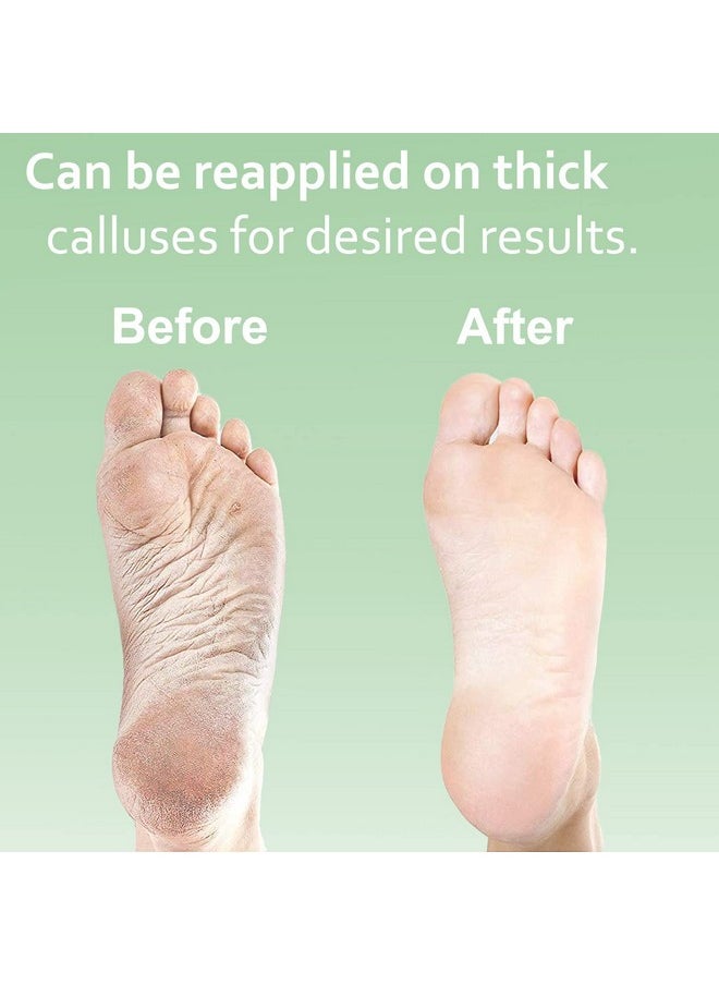 EntreFeet - Dr. Entre'S Callus Remover Gel & Foot File: Extra Strength Callus Remover For Feet Foot Callus Remover Care Pedicure Tools Supplies Spa Kit Dead Skin Scrubber 4 Oz - Image 1