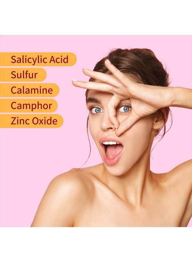 Ebanel Acne Drying Lotion, Overnight Salicylic Acid and Sulfur Cystic Acne Spot Treatment for Face and Body, Pimple Cream Spot Treatment, Dries Out Pimples, Cysts, Blemishes, Zits, and Clogged Pores  - Image 3