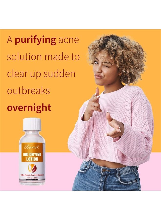 Ebanel Acne Drying Lotion, Overnight Salicylic Acid and Sulfur Cystic Acne Spot Treatment for Face and Body, Pimple Cream Spot Treatment, Dries Out Pimples, Cysts, Blemishes, Zits, and Clogged Pores  - Image 4