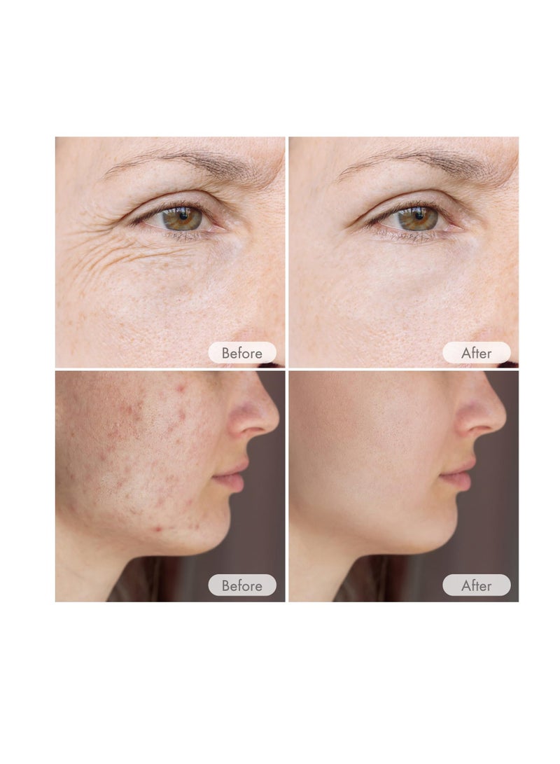 Excefore Microneedling Pen, Professional Automatic Serum Wireless Microneedling With 12 Pins Cartridges, Skinpen, Auto Pen, Microneedle Pen For Face And Body - Image 4