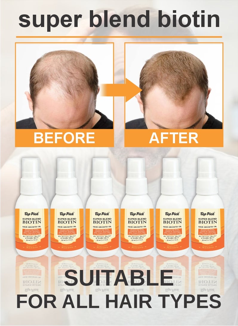 Top Pick Super Blend Rosemary Mint Biotin Hair Growth Oil with Vit B5 & E, Argan Oil & 21+ Natural Herbs & Oils For Scalp & Hair Strengthening Oil – Controls Hair Fall and Promotes Healthy Hair Growth 50ML Pack Of 6