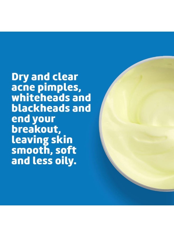 دي لا كروز مرهم علاج حب الشباب مع 10% كبريتات، للفعالية القصوى، 2.6 أونصة (73.7 جم) - Image 3