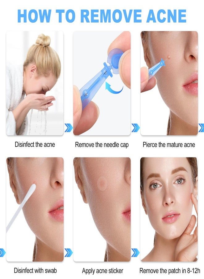 Refesta 50PCS Disposable Acne Needle & 72 Dots Pimple Stickers - Ultrafine Pimple Popper Needle - Image 4