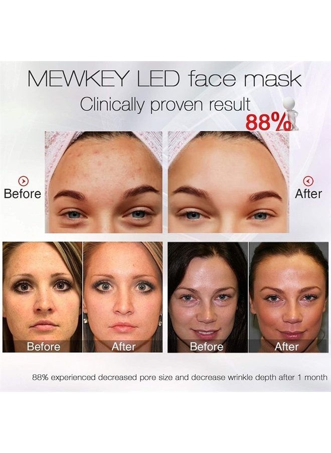 NEWKEY - Led Face Mask Light Therapy, 7 led Light Therapy for Facial Skin Care - Blue & Red Light for Acne Photon Mask - Korea PDT Technology for Acne Reduction - Image 1