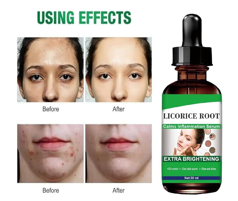 Licorice Root Serum Moisturization AntiAging Even Skin Tone lighten pigmentation radiant skin tone 30ml - Image 3