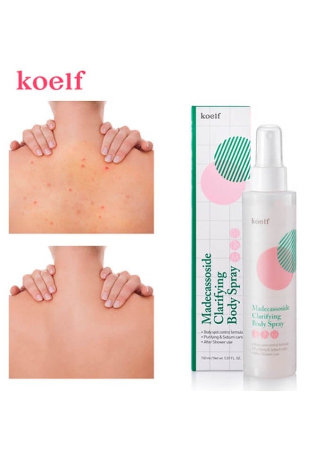 كويلف بخاخ جسم ماديكاسوسايد كويلف لتنقية وعلاج حب الشباب في الوجه والظهر والصدر والتحكم البقع من بيتيفي عبوة 150 ملليلتر - Image 5