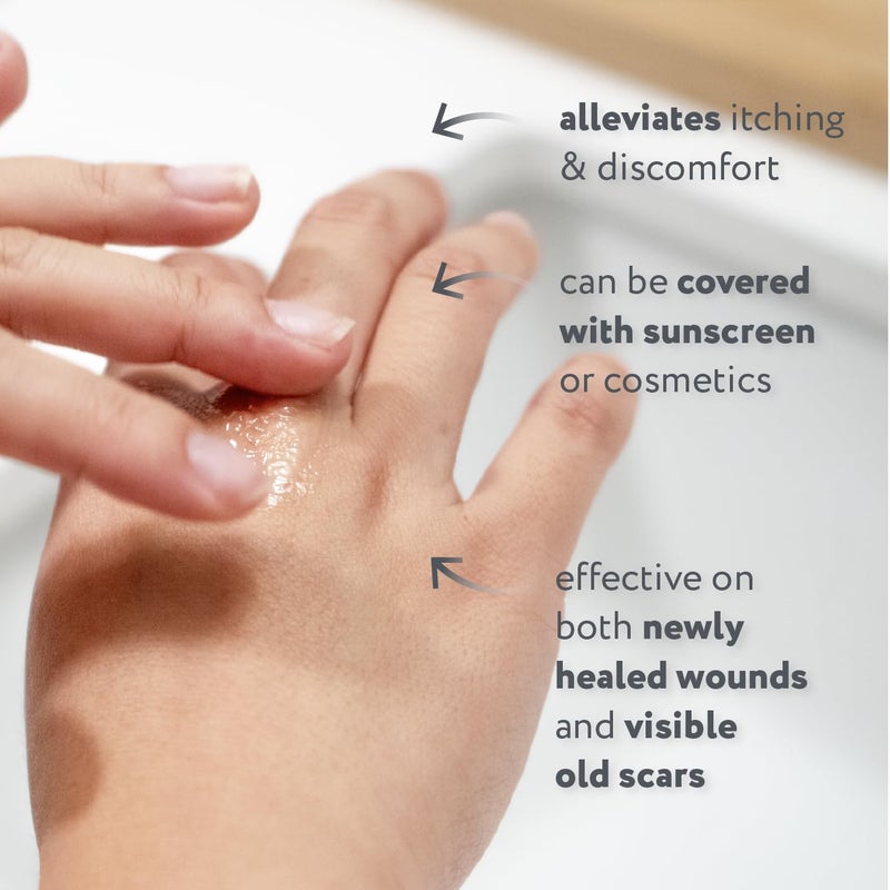 ScarAway Complete Scar Treatment Kit, Clinically Supported Treatment (Pack of 2) Tan Medical-Grade Silicone Scar Sheets (1.5" x 3") and Silicone Gel (0.35 Oz), Water-Resistant & Self-Adhesive - Image 4