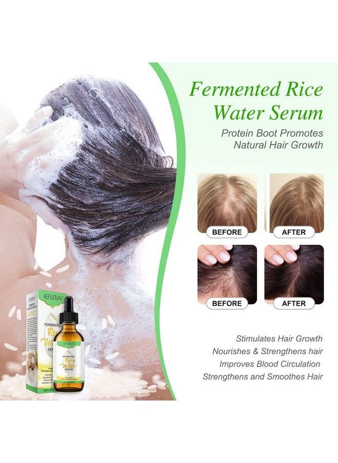 Sefudun - 2 Pack Rice Water For Hair Growth Hair Oil For Dry Damaged Hair And Growth Hair Growth Serum For Stronger Thicker Longer Hair Natural Hair Moisturizer & Conditioner With Vitamin & Mineral 2.02 Fl.Oz - Image 1