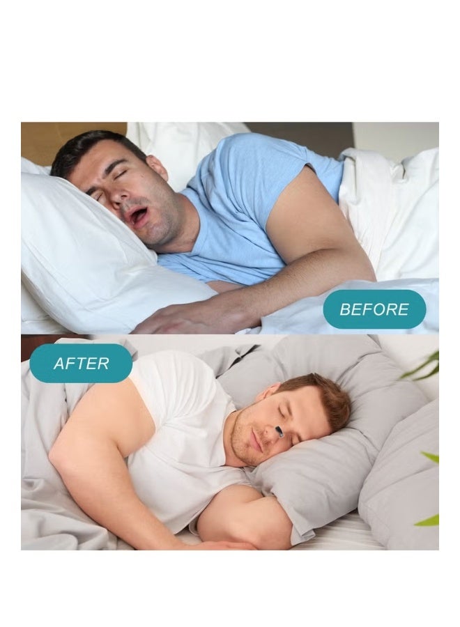 BIVATU Anti-Snoring Nose Strips | Comfortable Nasal Strips for Better Airflow & Night Comfort - Image 4