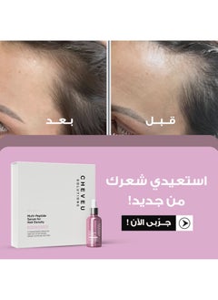CHEVEU SOLUTIONS Cheveu Complex™ Hair Growth Kit for Women | 90-Day Supply with 5% AQUAXYL™  - Image 3