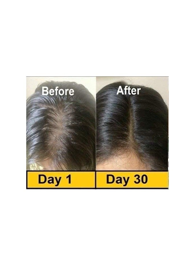 إيفيت فيتامين هـ غذائي  كبسولة - Image 4