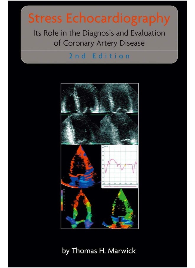 Stress Echocardiography: Its Role in the Diagnosis and Evaluation of Coronary Artery Disease 