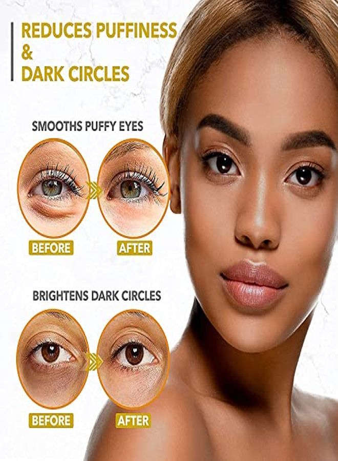 Arvesa Eye Patches - 24K Gold Under Eye Mask For Puffy Eyes, Dark Circles, Eye Bags, Wrinkles, Puffiness With Collagen - Anti Aging Skincare Eye Patch Treatment Masks - Hydrating Under Eye Gel Pads  - Image 4