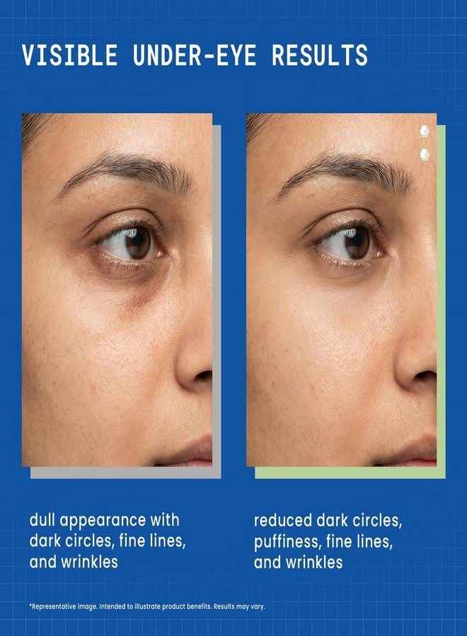 DERMDOC Niaglow 4% Niacinamide Under Eye Gel, 15gm | Reduces Dark Circles & Puffiness | Cools & Soothes | Lightweight | Fast Absorbing | Brightening Eye Care Gel for Tired Eyes & Fine Lines - Image 2
