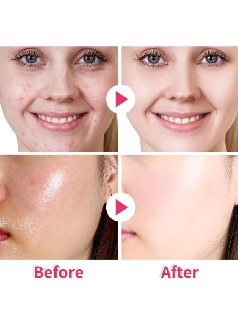 ATRJSZ 40Pcs Kojic Acid & Turmeric Cleansing Pads For Dark Spots | Turmeric Kojic Acid Cleansing Pads Helps Balance Skin Oil & Water, Fade Spot, Remove Excess Keratin, Clean oil Refines Pores - Image 3