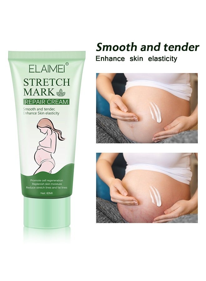 Elaimei Stretch Mark Repair Cream Natural Plant Essence Formula Maternity Skin Treatmentpregnancy Scarsrepair Cream 60g  - Image 1