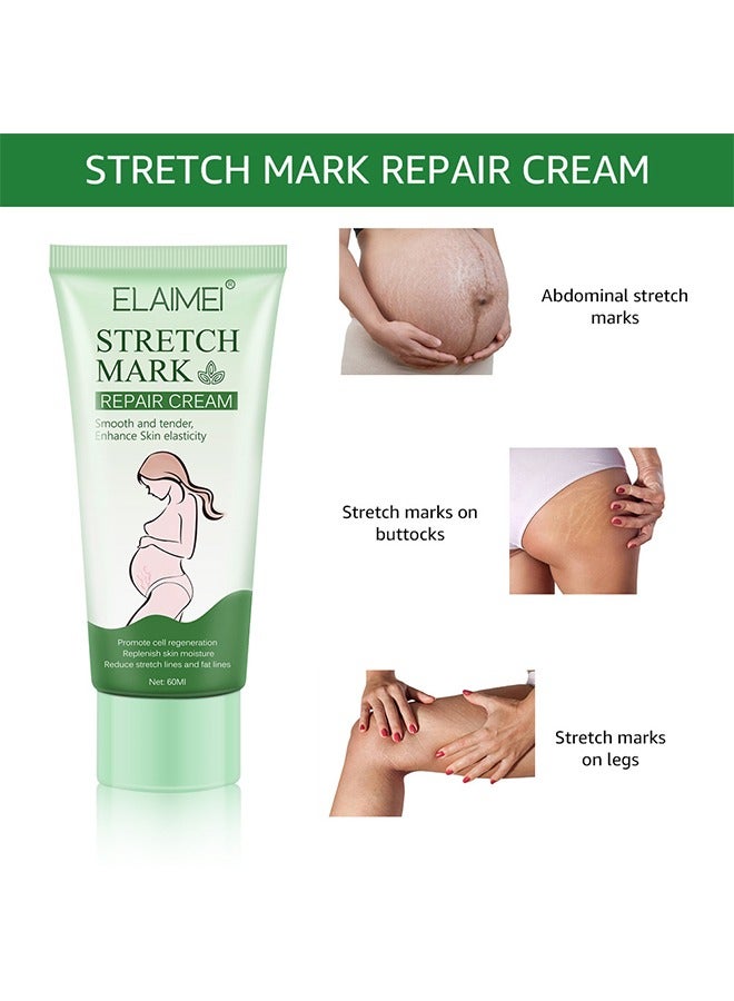 Elaimei Stretch Mark Repair Cream Natural Plant Essence Formula Maternity Skin Treatmentpregnancy Scarsrepair Cream 60g  - Image 5