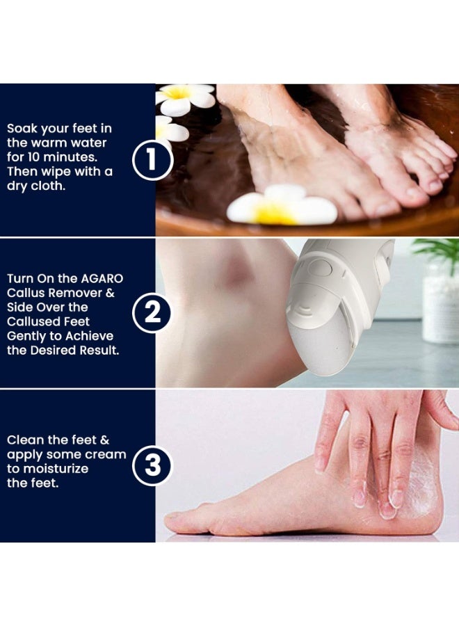 AGARO Callus Remover Replaceable Heads, 3 Pcs, Callus & Dead Skin Removal Filer, Pedicure At Home - Image 2