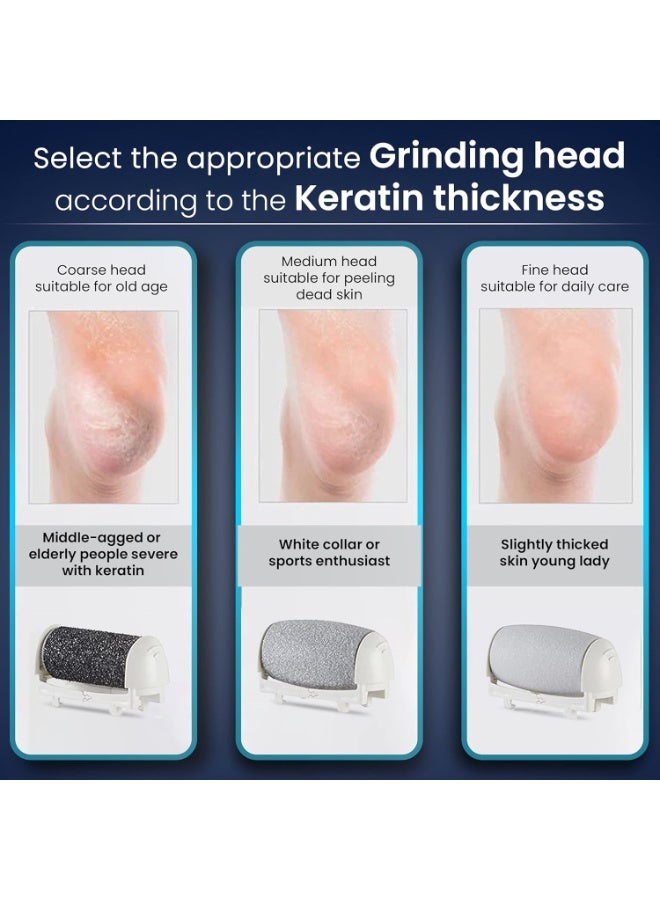 AGARO Callus Remover Replaceable Heads, 3 Pcs, Callus & Dead Skin Removal Filer, Pedicure At Home - Image 3
