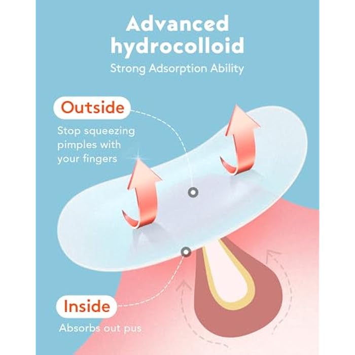 LitBear Large Acne Pimple Patches, 5 Sizes 80 Patches for Large Breakouts, Acne Patches for Face, Chin or Body, Acne Spot Patch with Tea Tree & Calendula Oil, Hydrocolloid Bandages for Acne Skin - Image 5