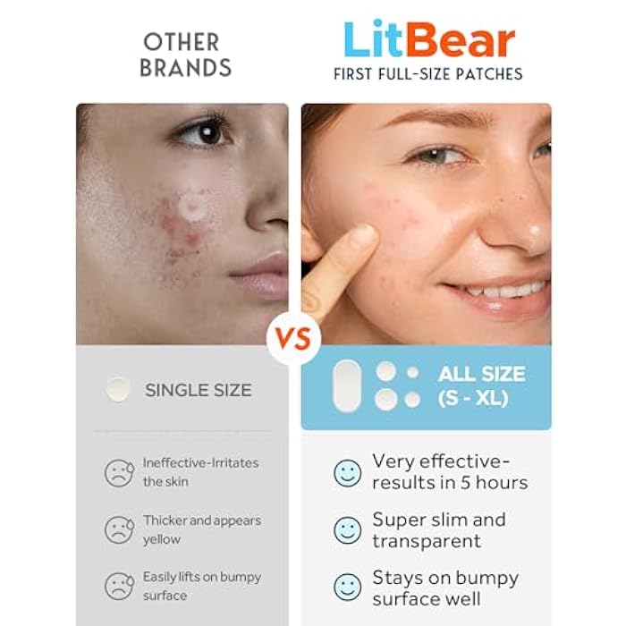 LitBear Large Acne Pimple Patches, 5 Sizes 80 Patches for Large Breakouts, Acne Patches for Face, Chin or Body, Acne Spot Patch with Tea Tree & Calendula Oil, Hydrocolloid Bandages for Acne Skin - Image 3