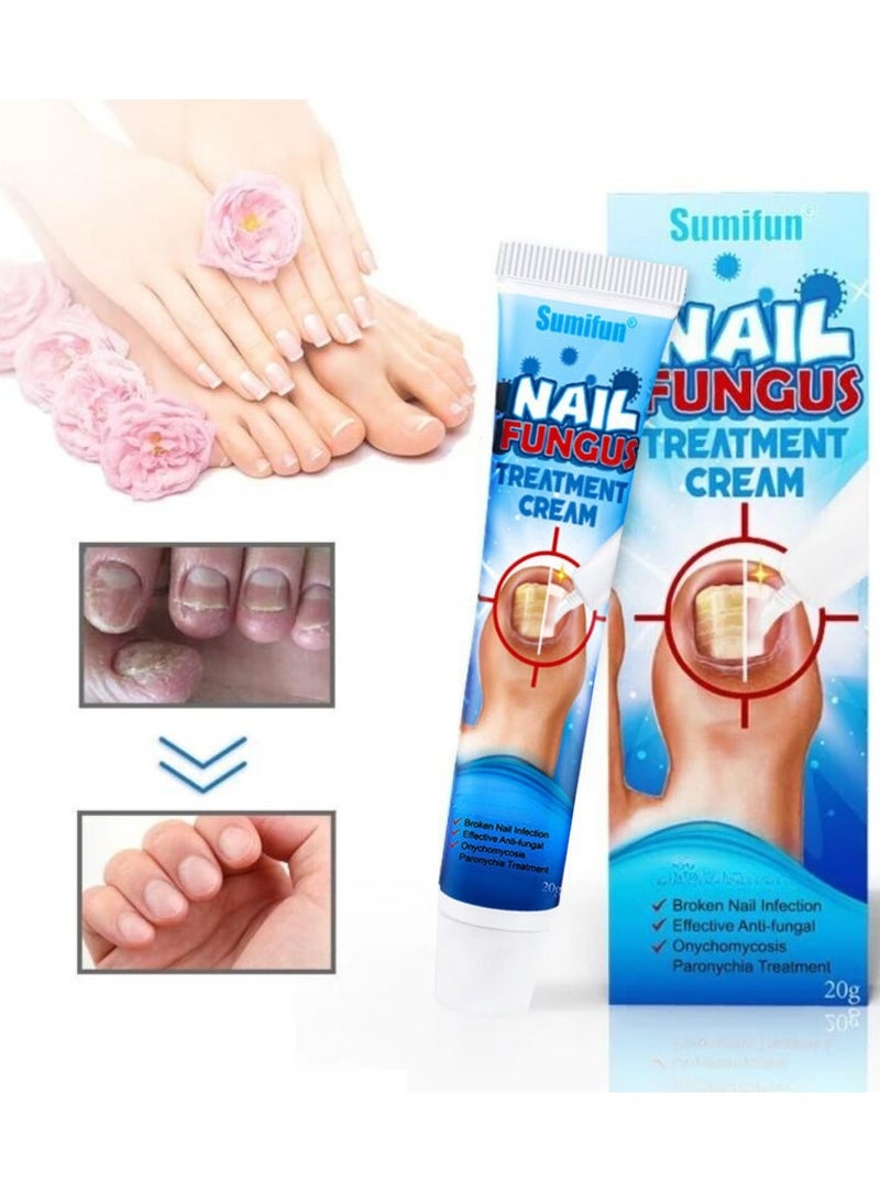 Sumifun كريم علاج فطريات الأظافر يعزز نمو الأظافر يحسن مظهر الأظافر المتقدمة في السن عناية مغذية بالأظافر وتهدئة انزعاج الأظافر كريم إصلاح الأظافر 20 جرام - Image 1