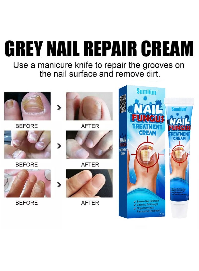 Sumifun كريم علاج فطريات الأظافر يعزز نمو الأظافر يحسن مظهر الأظافر المتقدمة في السن عناية مغذية بالأظافر وتهدئة انزعاج الأظافر كريم إصلاح الأظافر 20 جرام - Image 2