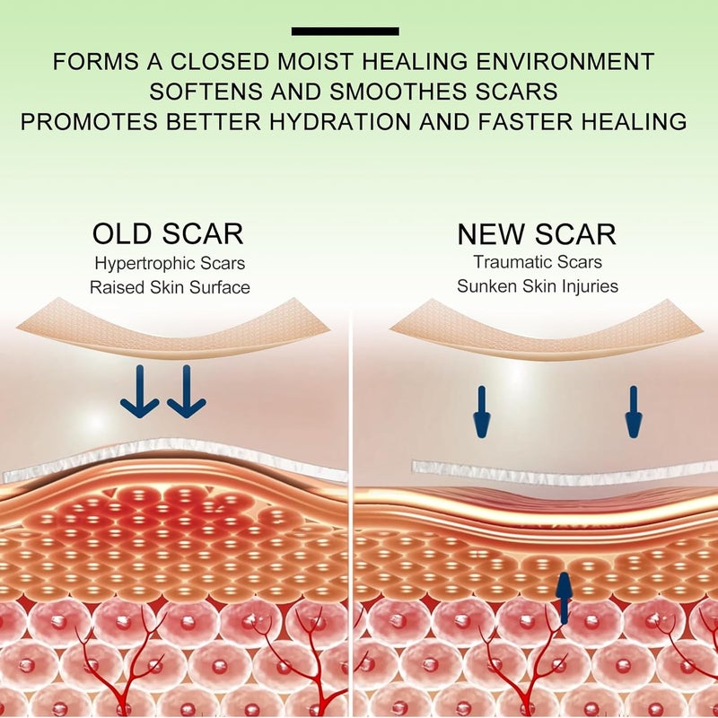 Silicone Scar Sheets Clear Silicon Gel Scar Sheets Invisible Scar Tape16 x 120Roll3M Scar Strips for Surgical Scars Medical Grade Scar Removal Sheets for CSection Breast Keloid et - Image 3