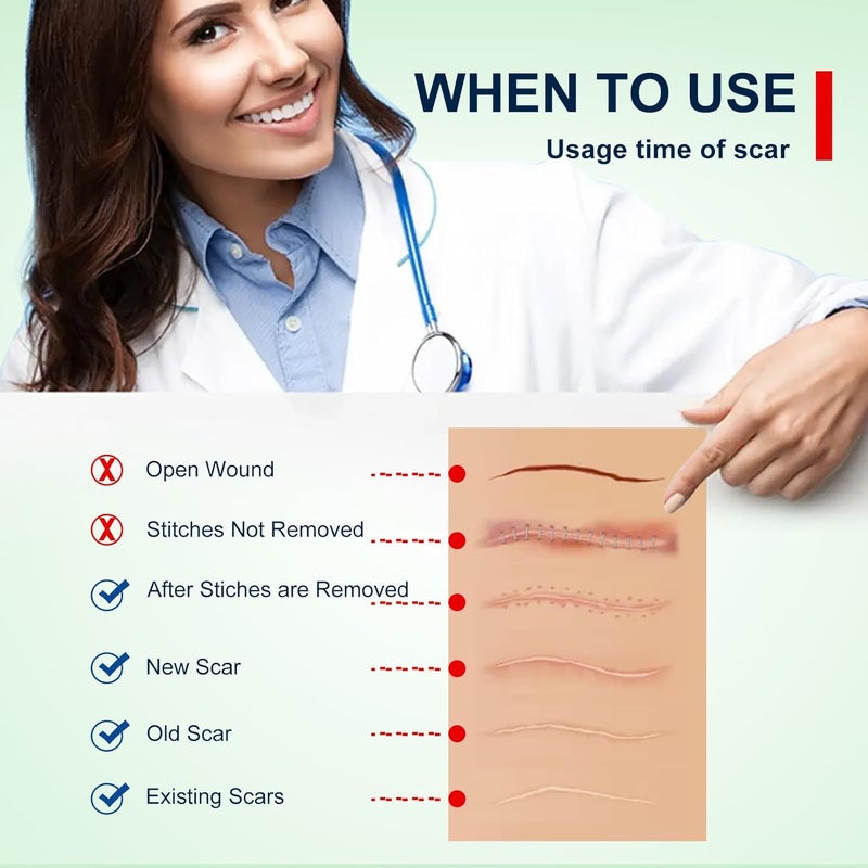 Silicone Scar Sheets Clear Silicon Gel Scar Sheets Invisible Scar Tape16 x 120Roll3M Scar Strips for Surgical Scars Medical Grade Scar Removal Sheets for CSection Breast Keloid et - Image 4