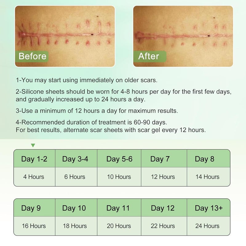 Silicone Scar Sheets Clear Silicon Gel Scar Sheets Invisible Scar Tape16 x 120Roll3M Scar Strips for Surgical Scars Medical Grade Scar Removal Sheets for CSection Breast Keloid et - Image 5