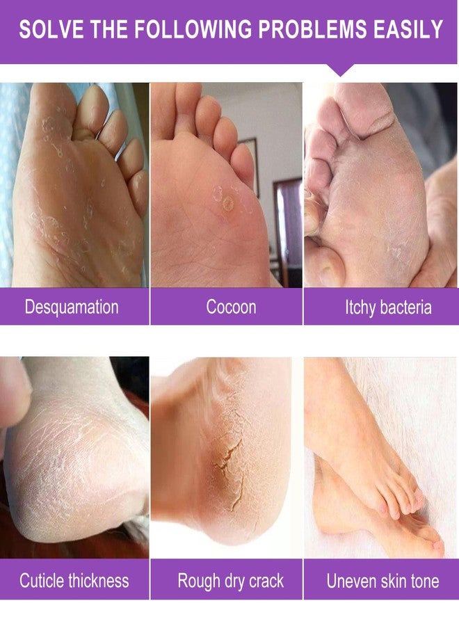 WEIDA SIGN Foot Peel Mask 2 Pack,Peeling Away Calluses and Dead Skin Cells, Natural Exfoliator for Dry Dead Skin, Callus, Repair Rough Heels for Men Women (Lavender) - Image 3