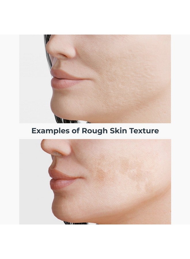 nassif md Nassifmd Even Correct & Renew Retexturizing Pads Mandelic Acid Resurfacing Pads Promote New Cells To Defeat Acne Uneven Texture & Hyperpigmentation Niacinamide Toner Minimizes & Tightens Pores - Image 3