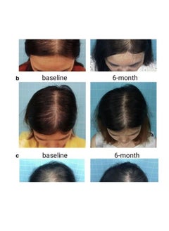 Dar Al Dawa Hairgrow 5% Minoxidil 50ml  - Image 3
