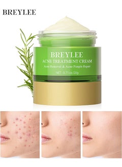 Breylee Acne Treatment Cream, Acne Removal Acne Pimple Repair Cream, Natural Cystic Acne Treatment, Premium Acne Scar Cream And Pimple Remover, 20G  - Image 1
