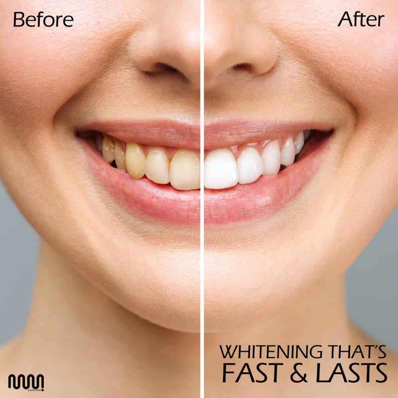 MasterMedi Teeth Whitening Strips, Non-Sensitive White Strip for Teeth Whitening, 14 Treatments - Image 5
