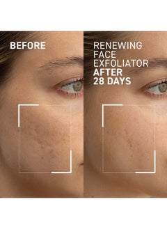 Dr. Brandt Skincare Dr. Brandt Microdermabrasion Renewing Face Exfoliator - Reduces Dull Skin, Uneven Texture, Fine Lines, Acne Scars, and Wrinkles - 2.1 oz / 60 g  - Image 2