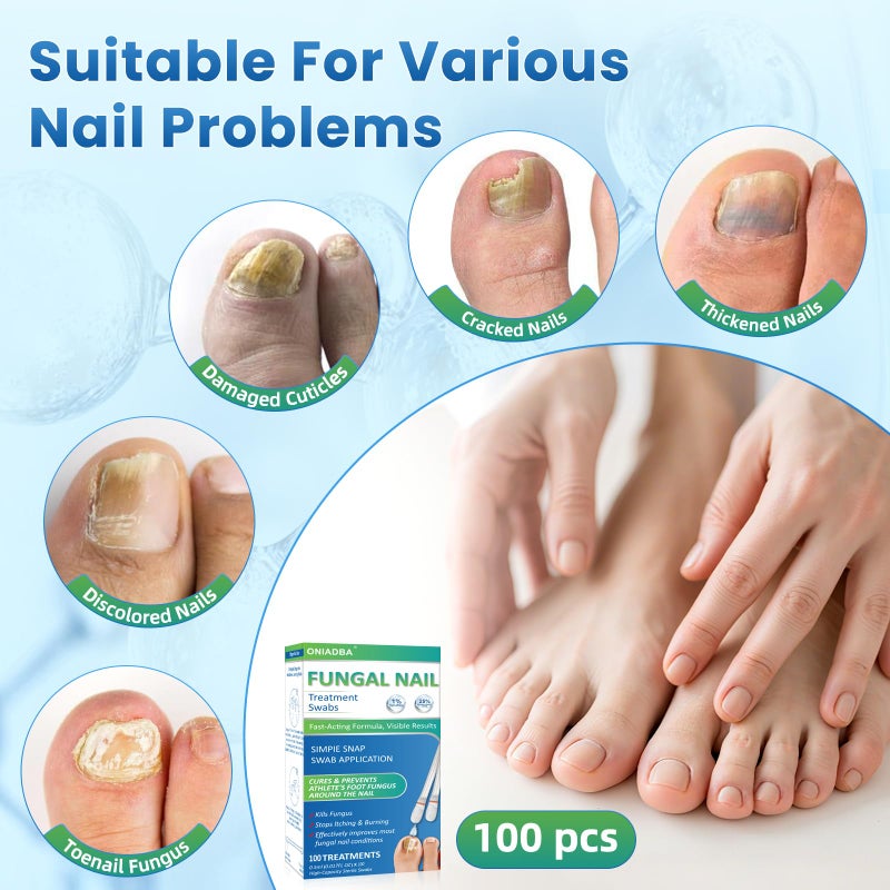 ONIADBA Fungal Nail Treatment Swabsâ€“100 Ct, Extra Strength Toenail & Athleteâ€™s Foot Fungus Treatment with 25% Undecylenic Acid, Damaged, Discolored & Thick Nails, Restores Healthy Nail Growth - Image 2