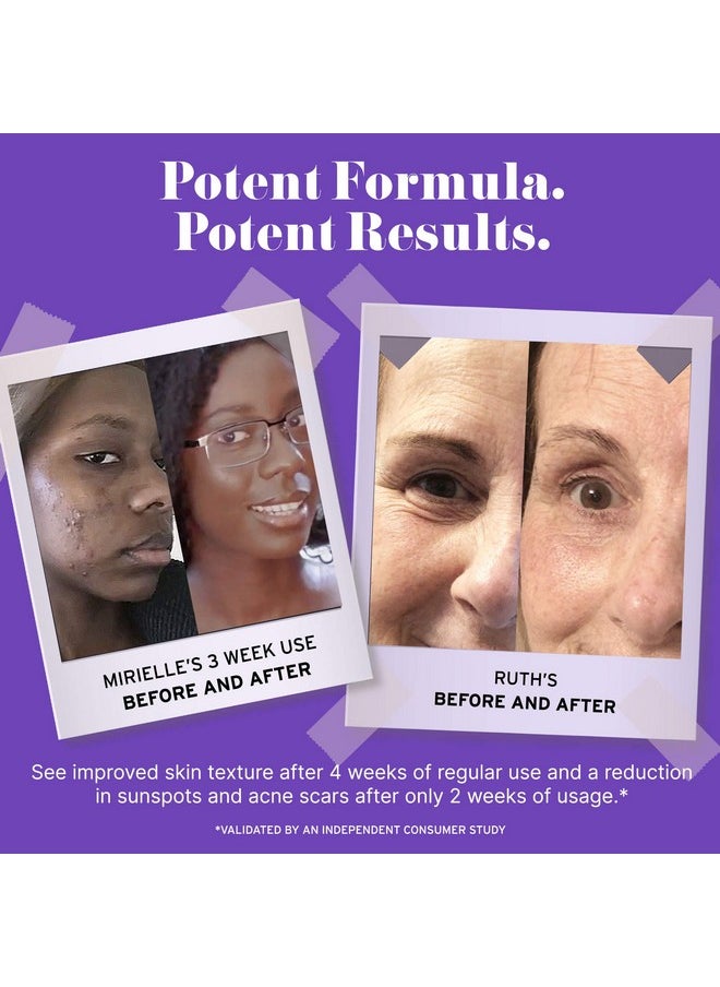 NO B. S. NO BAD STUFF No Bs Retinol Cream For Face With Hyaluronic Acid And Vitamin E Retinol Night Cream For Spot Treatment Vegan Wrinkle Cream And Spots Corrector For Face. Includes Free Skincare Samples  - Image 5