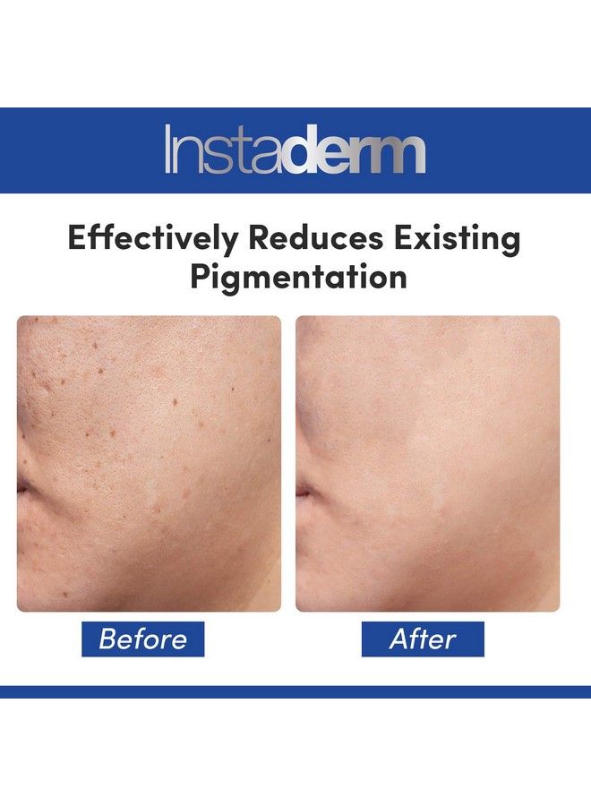 Instaderm Dark Spot Corrector Serum Reduces Dark Spots Sun Spots Age Spots Acne Scars & Freckles. Rejuvenates Texture & Tone With Antiaging Benefits. - Image 5