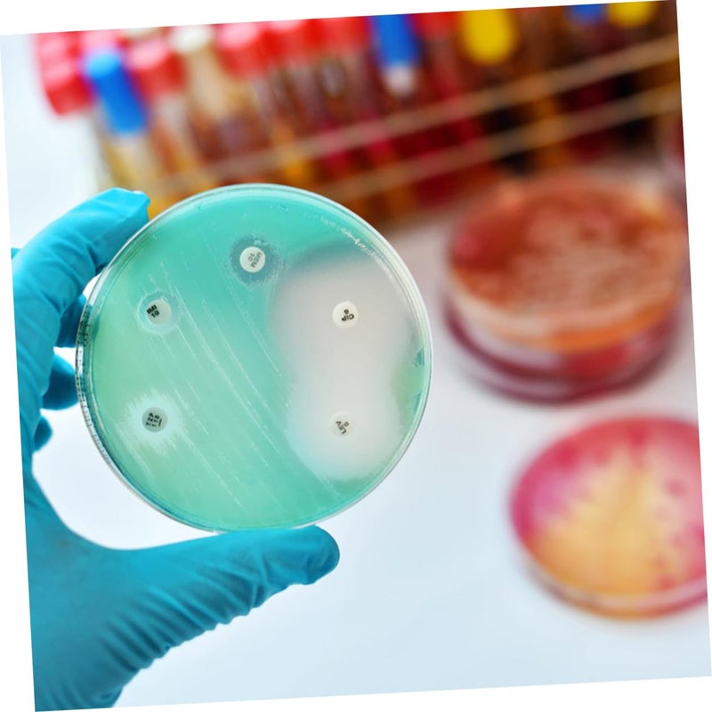 Transparent Plastic Petri Dish With Lid 10pcs For Science Experiments And Tissue Culture - Image 5