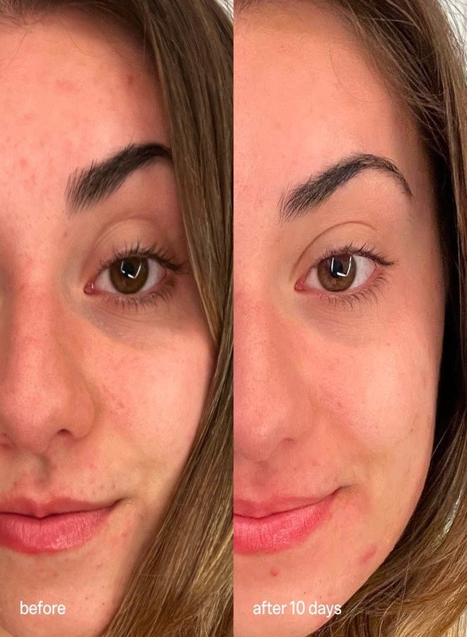 بابل مورنينج رايز - كريم تفتيح منطقة العين، 15 مل | كريم مرطب لمنطقة تحت العين، يفتح الهالات السوداء، ينعم وينعش منطقة العين - Image 5