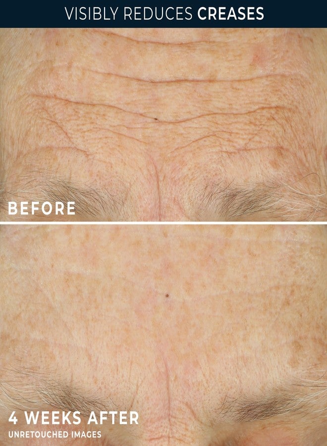 RoC Crepe Repair Anti Aging Daily Face Moisturizer & Neck Firming Cream (1.7 oz) + RoC Retinol Wrinkle Smoothing Capsules (7 CT), Skin Care Routine for Women and Men - Image 5