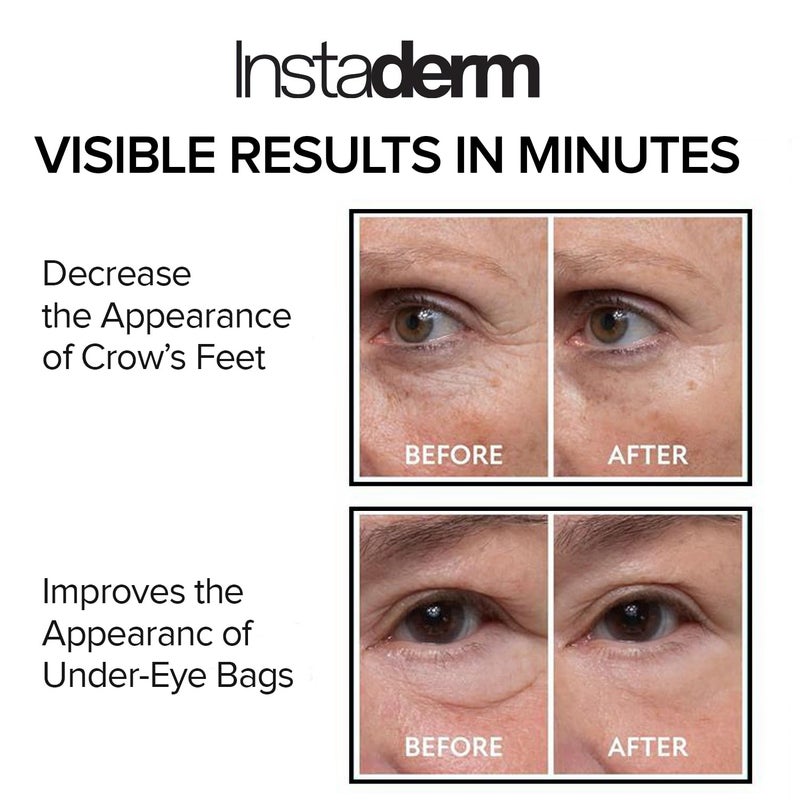 Instaderm علاج فوري لانتفاخ العين ورفعها - يزيل أكياس تحت العين والانتفاخ. يقضي على الهالات السوداء والتجاعيد. كريم مرطب طبيعي خالي من العمر. يختفي أمام عينيك في غضون دقائق. - Image 4