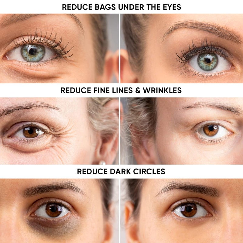 Instaderm علاج فوري لانتفاخ العين ورفعها - يزيل أكياس تحت العين والانتفاخ. يقضي على الهالات السوداء والتجاعيد. كريم مرطب طبيعي خالي من العمر. يختفي أمام عينيك في غضون دقائق. - Image 3