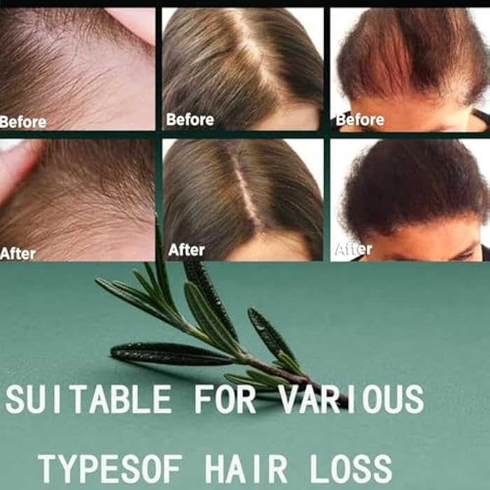 Rosemary Biotin Shampoo for Hair Growth - Sulfate-Free Volumizing Shampoo for Thinning Hair, Dry & Damaged Hair - Vegan, Color Safe with Keratin - Men & Women (2) - Image 3